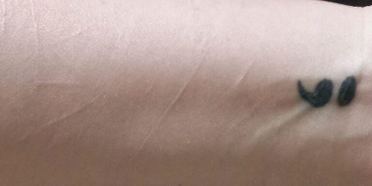 SCAR